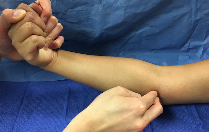 Golfer S Elbow Medial Epicondylitis Hand Surgery Resource